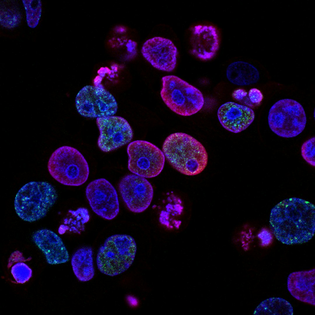 Single-Cell Protein from Microorganisms