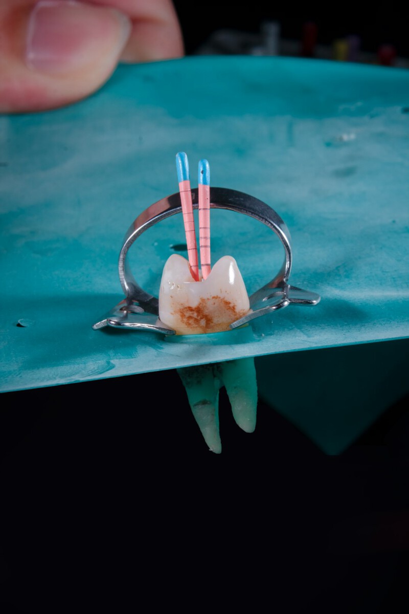Dental patient suffered fatal brain injury during implant procedure after snapping photo in chair saying 'fun never stops' — family secures legal settlement: Lawyers