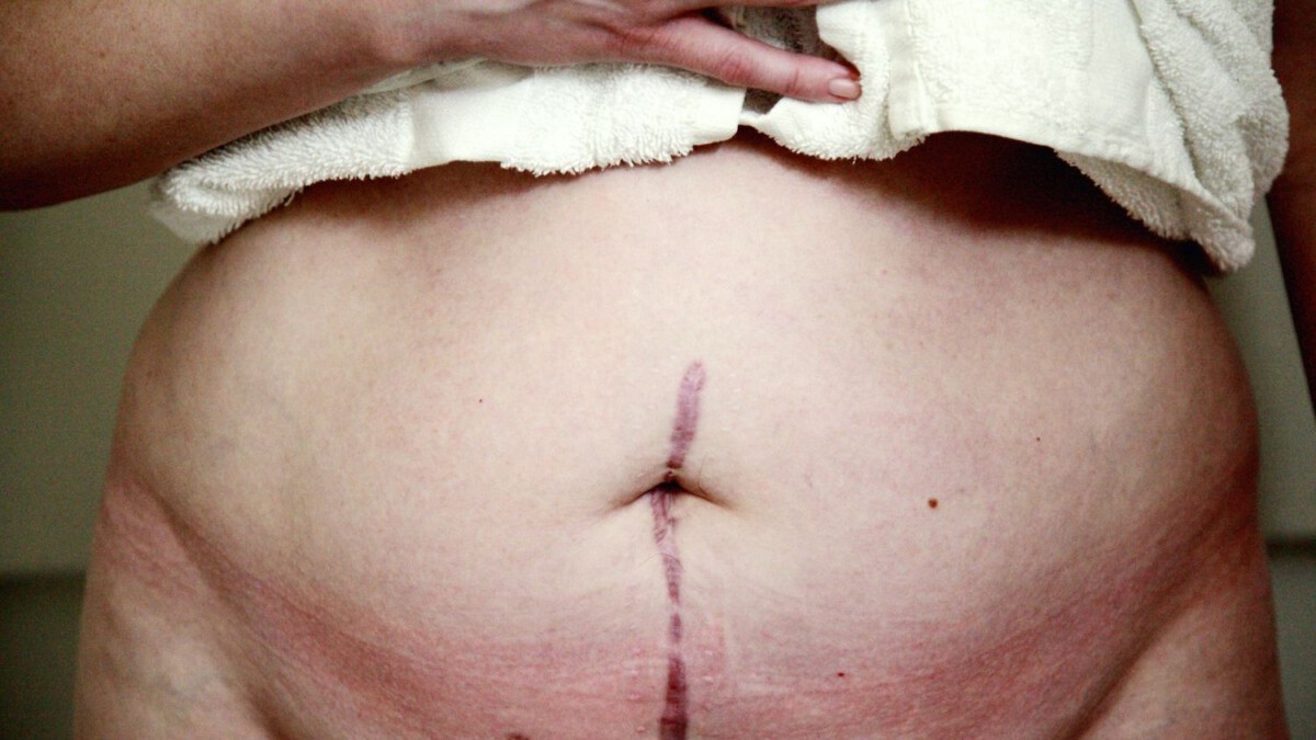 Iowa woman dies after routine hernia surgery as family claims doctors ignored red flags