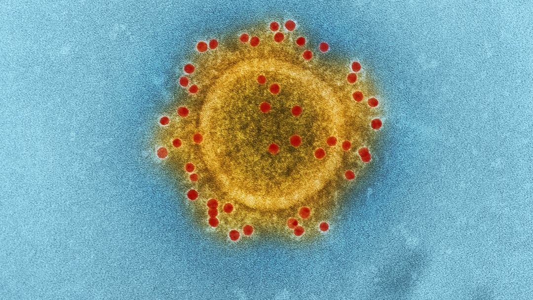 US CDC classifies hantavirus outbreak as 'level 3' emergency response