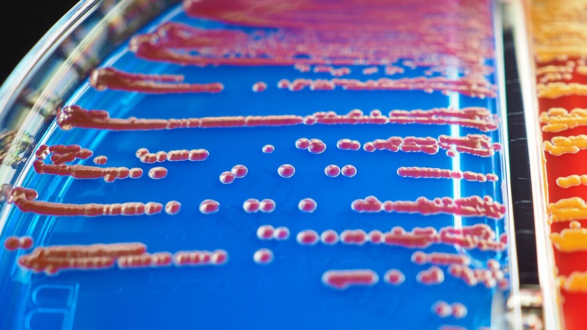 19 Legionella bacteria infections linked to Kaiser Bay Area hospital